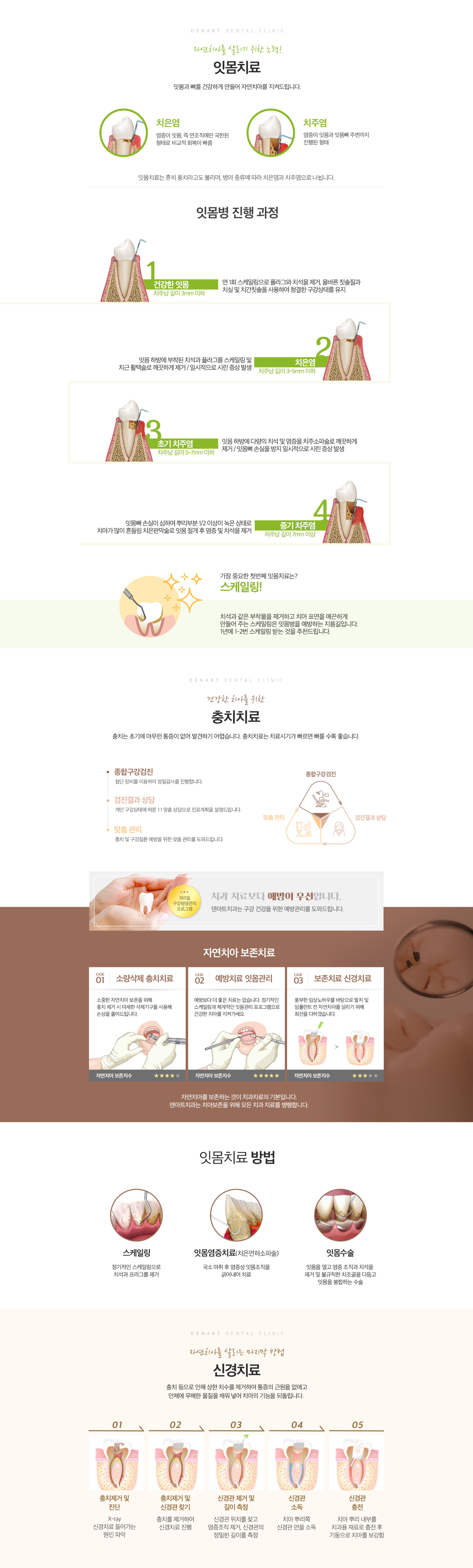 자연치아 살리기